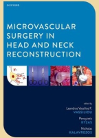 Microvascular Surgery in Head and Neck Reconstruction