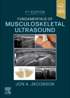 Fundamentals of Musculoskeletal Ultrasound