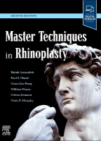 Master Techniques in Rhinoplasty