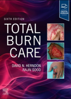 Total Burn Care