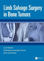Limb Salvage Surgery in Bone Tumors
