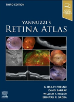 Yannuzzi's Retina Atlas