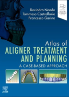 Atlas of Aligner Treatment and Planning