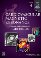 Cardiovascular Magnetic Resonance