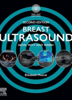 Breast Ultrasound