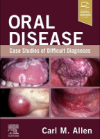 Oral Disease: Case Studies of Difficult Diagnoses