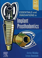 Essentials and Innovations in Implant Prosthodontics