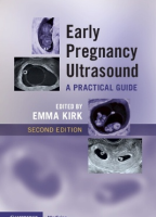Early Pregnancy Ultrasound