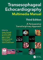 Transesophageal Echocardiography Multimedia Manual