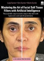 Mastering the Art of Facial Soft Tissue Fillers with Artificial Intelligence