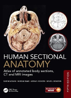 Human Sectional Anatomy