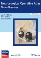Neurosurgical Operative Atlas: Neuro-Oncology