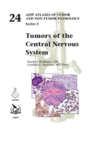 Tumors of the Central Nervous System