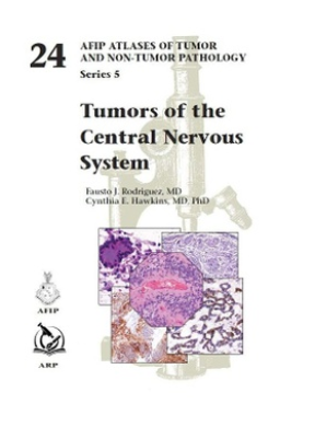 Tumors of the Central Nervous System - 9781933477640