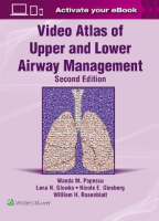 Video Atlas of Upper and Lower Airway Management: Print + eBook with Multimedia