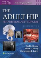 The Adult Hip: Hip Arthroplasty Surgery Print + eBook with Multimedia
