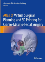 Atlas of Virtual Surgical Planning and 3D Printing for Cranio-Maxillo-Facial Surgery