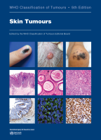 WHO Classification of Skin Tumours, 5th edition