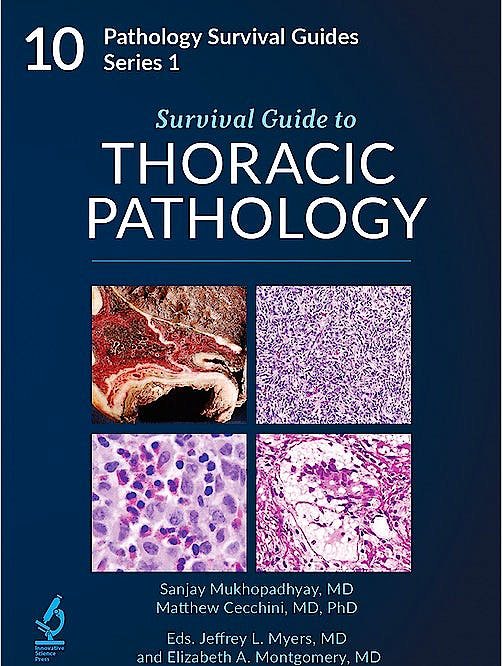 Survival Guide to Thoracic Pathology【新品】 Acco Shop - Survival Guide to Thoracic Pathology